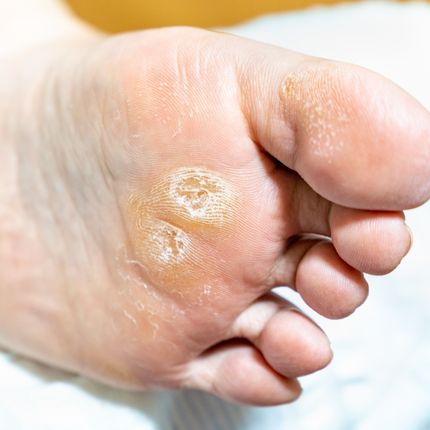 Nasır nasıl geçer